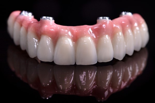 Can All On   Replace Multiple Teeth?
