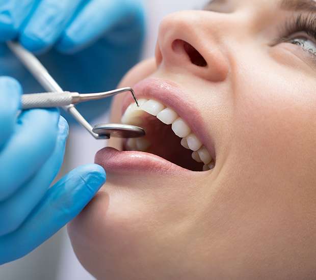North Mankato Dental Bonding