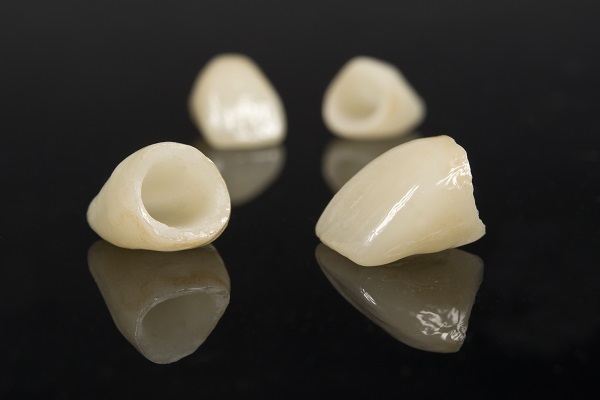 How Long Will A Dental Crown Last?