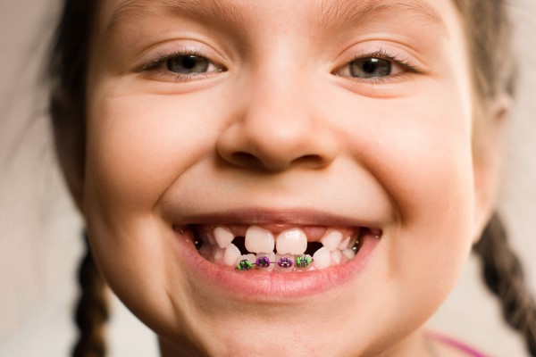 How To Determine If Your Child Needs Orthodontics