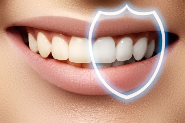 Professional Teeth Whitening Vs Over The Counter Teeth Whitening